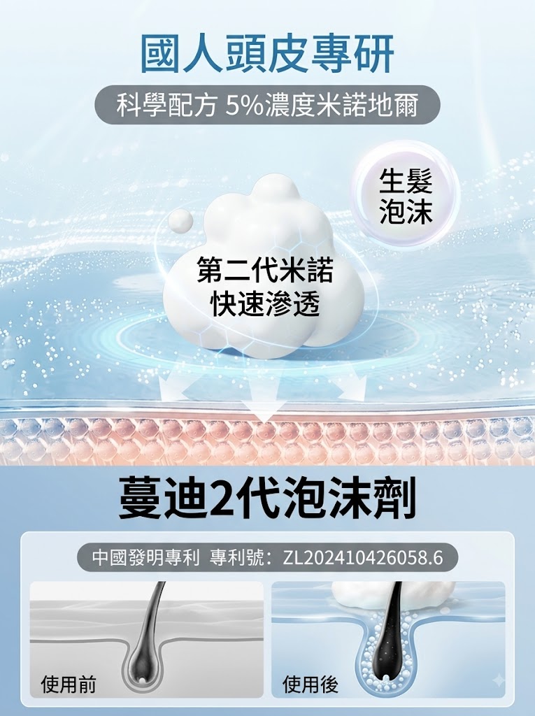 蔓迪米諾地爾泡沫劑60g曼迪生髮泡沫男性型防脫髮斑禿治脫生髮