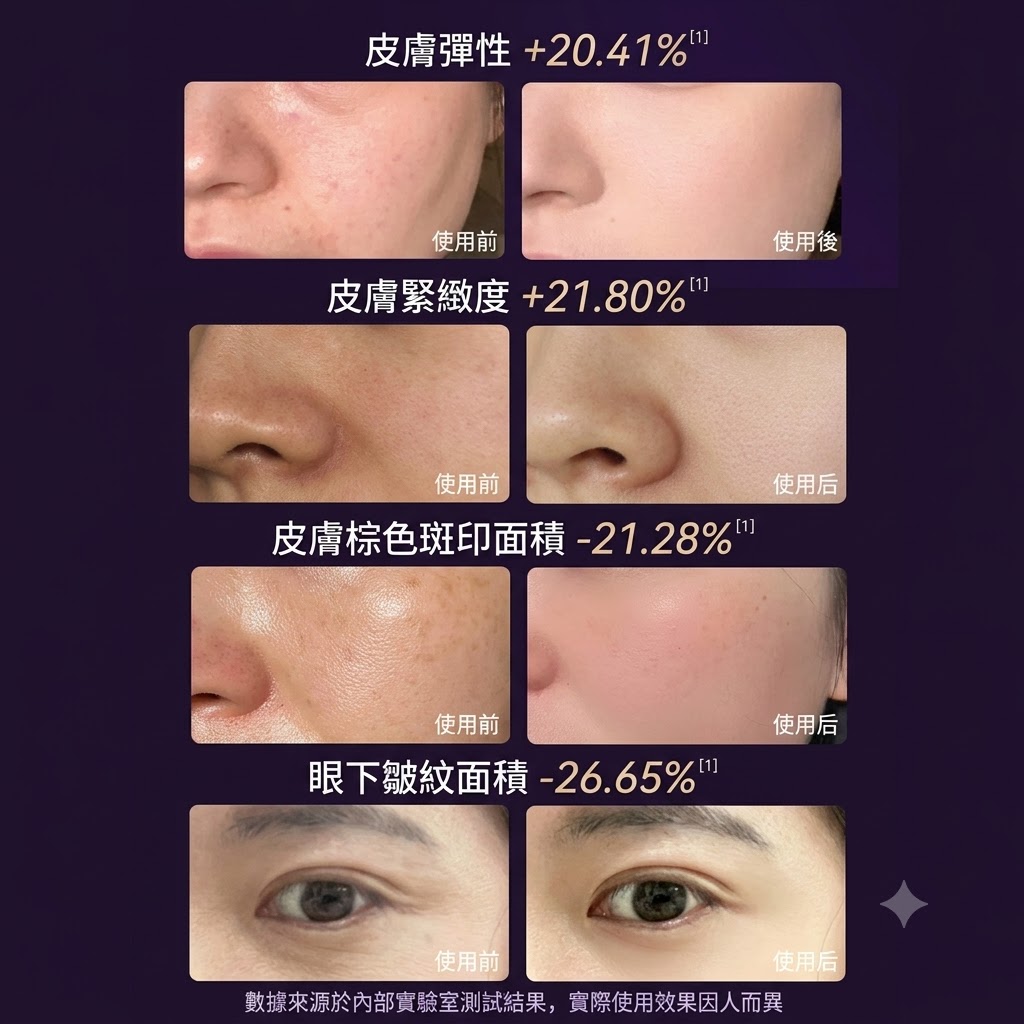 YD美膚面罩儀紅藍光祛煥膚儀淡痘印嫩膚亮白大小排燈家用美容儀