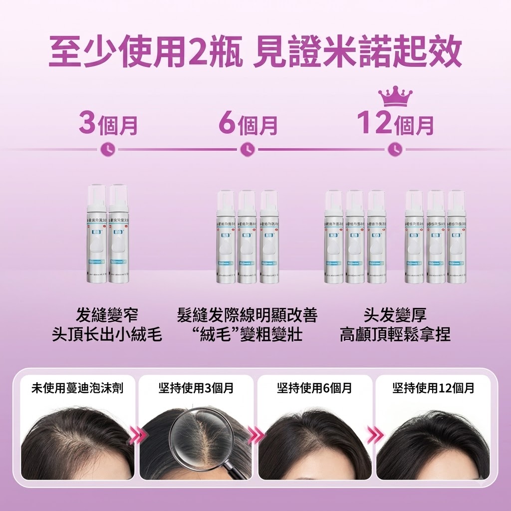 蔓迪第二代米諾地爾泡沫劑女士髪縫髮際線清爽生髮快速舒適非液