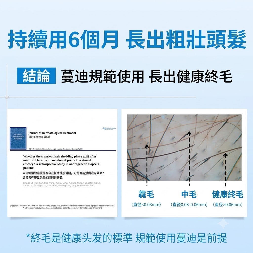 蔓迪米諾地爾酊男用曼迪正品米諾地爾生髮液官方旗艦店男士5%脱髮