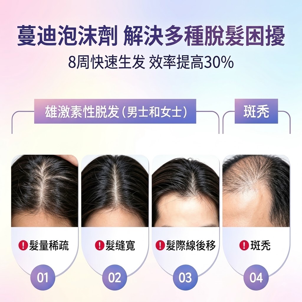 蔓迪第二代米諾地爾泡沫劑女士髪縫髮際線清爽生髮快速舒適非液