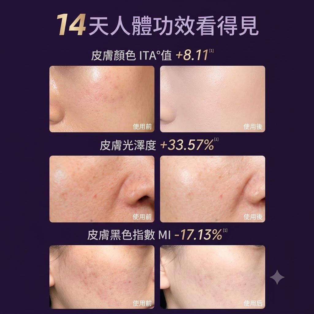 YD美膚面罩儀紅藍光祛煥膚儀淡痘印嫩膚亮白大小排燈家用美容儀