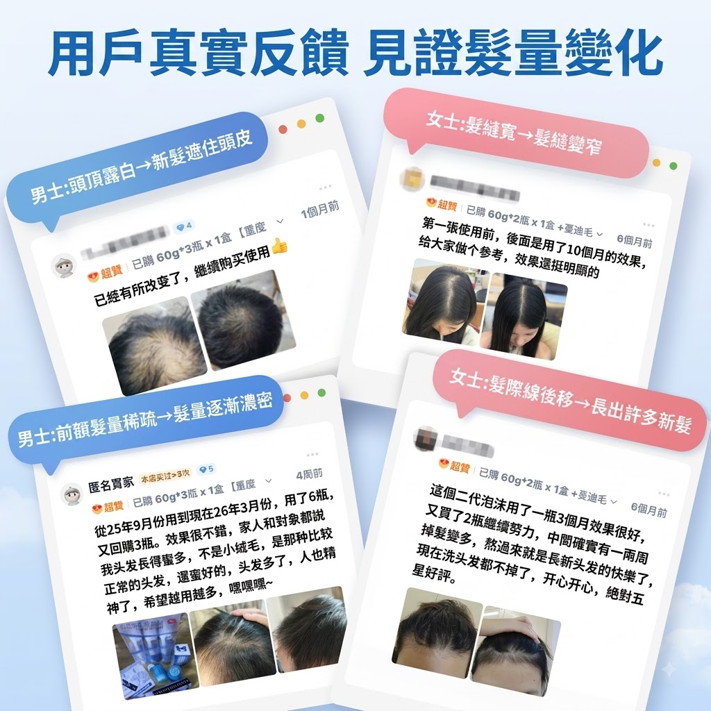 蔓迪米諾地爾泡沫劑60g曼迪生髮泡沫男性型防脫髮斑禿治脫生髮