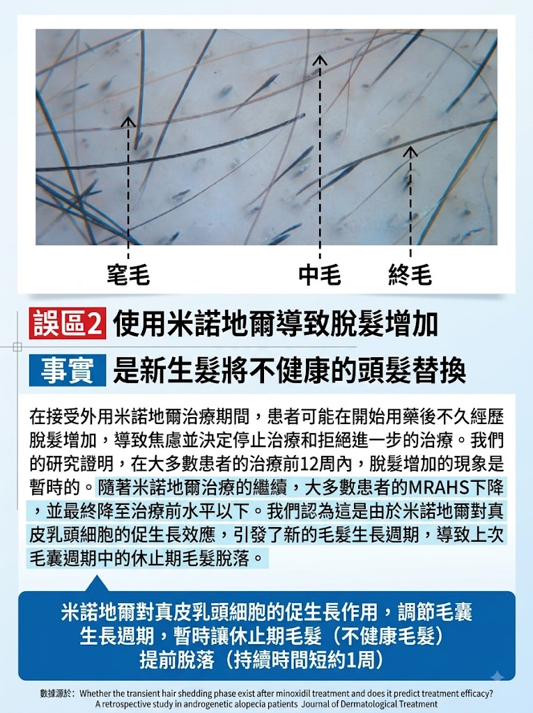蔓迪米諾地爾泡沫劑60g曼迪生髮泡沫男性型防脫髮斑禿治脫生髮