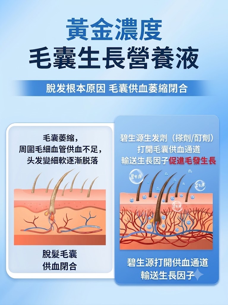 碧生源米諾地爾酊男用防脫髮生髮液密發育發溶液生髮水正品旗艦店