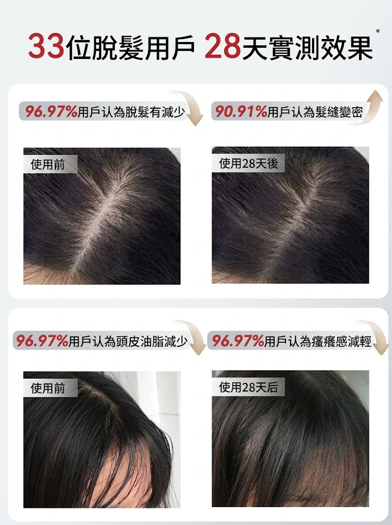 集怡嘉電流梳健發儀臭氧梳紅光梳高頻微電流梳按摩梳
