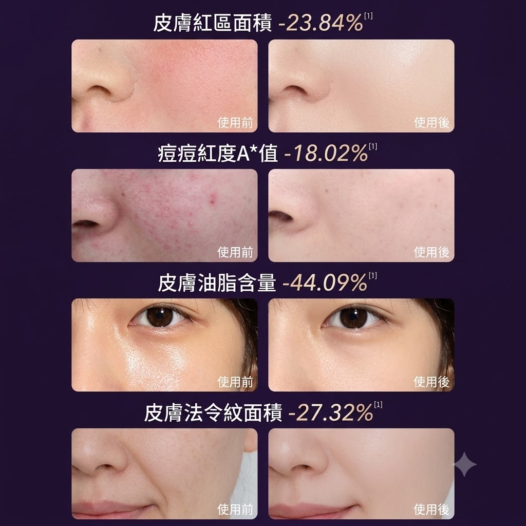 YD美膚面罩儀紅藍光祛煥膚儀淡痘印嫩膚亮白大小排燈家用美容儀