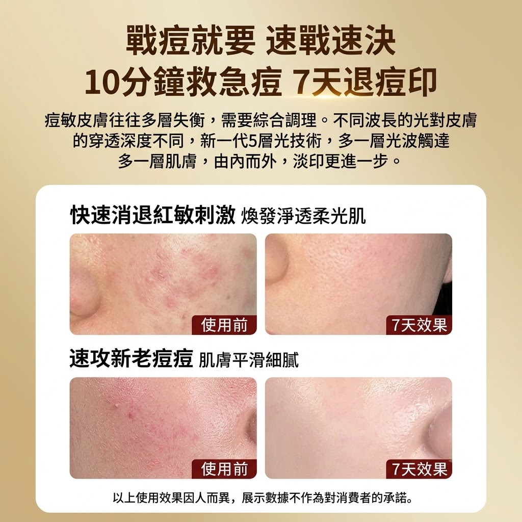 光子嫩膚儀led紅藍光祛痘面罩美容儀家用臉部美白麪膜儀器大排燈