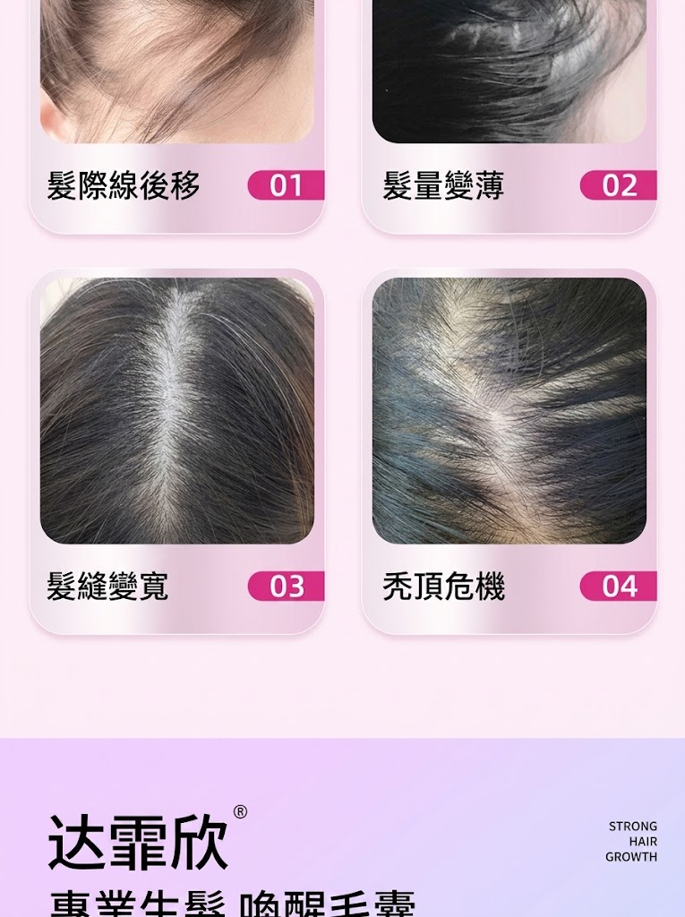 達霏欣米諾地爾女士生髮液2%搽劑藥品非防脱髮洗髮水官方正品