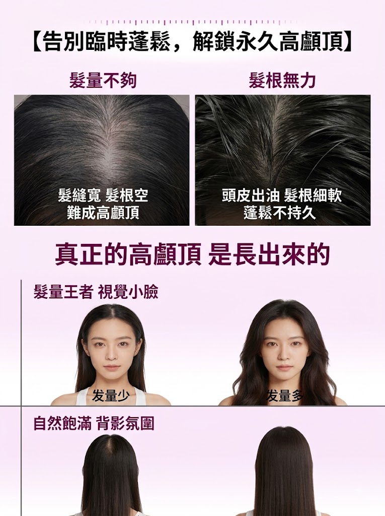 蔓迪第二代米諾地爾泡沫劑女士髪縫髮際線清爽生髮快速舒適非液