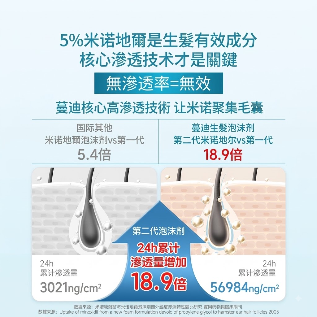 蔓迪米諾地爾泡沫劑60g曼迪生髮泡沫男性型防脫髮斑禿治脫生髮
