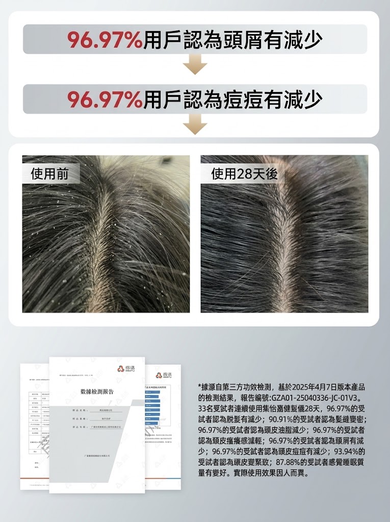 集怡嘉電流梳健發儀臭氧梳紅光梳高頻微電流梳按摩梳