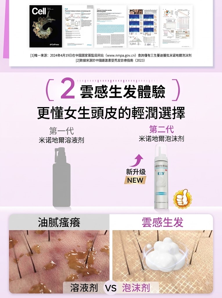 蔓迪第二代米諾地爾泡沫劑女士髪縫髮際線清爽生髮快速舒適非液