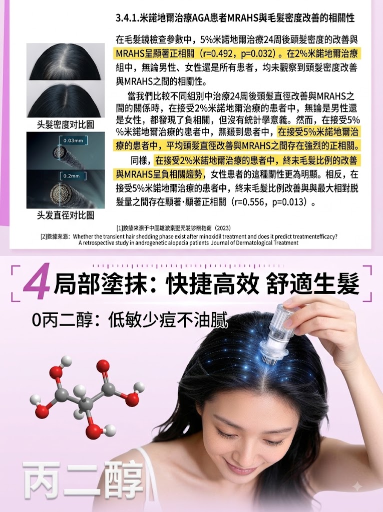 蔓迪第二代米諾地爾泡沫劑女士髪縫髮際線清爽生髮快速舒適非液